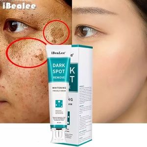 Whitening Freckle Cream Remove Melasma Cream Remove Dark Spots Melanin Brighten